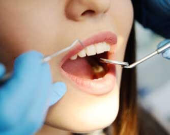 Dentiste Moumen Imane (dentiste) BENI YAKHLEF